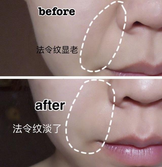 如何消除额头八字纹 如何消除额头八字纹