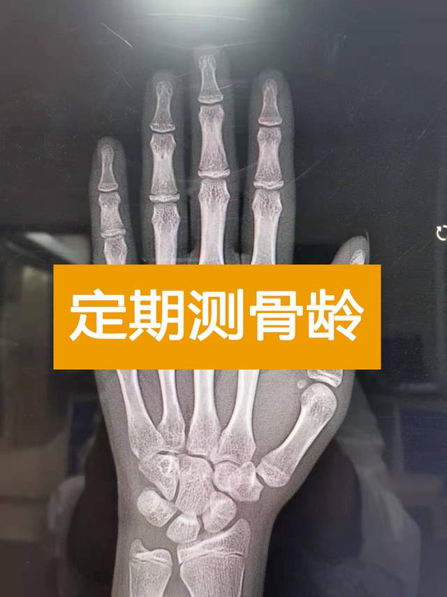 八字预测身高 八字预测身高