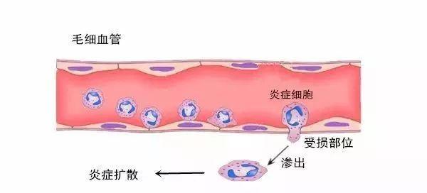 容易长痘是八字哪里出了问题 容易长痘是八字哪里出了问题