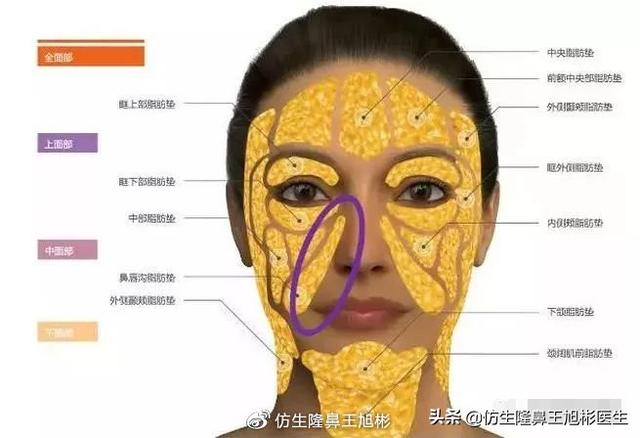 垫鼻子可以去八字纹吗 垫鼻子可以去八字纹吗