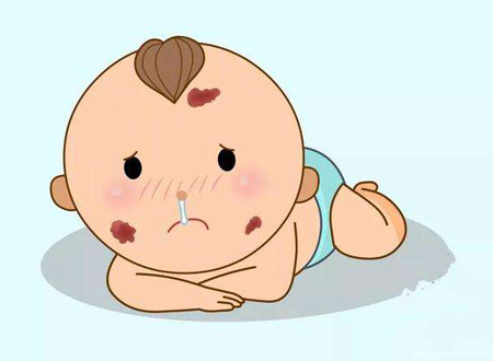 孩子有胎记好吗