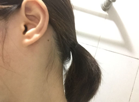 耳朵后长痣命运