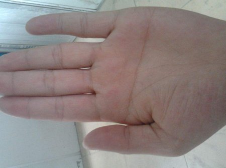 女人断掌手相特征