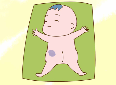 屁股上有胎记好吗