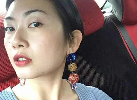 痣多的人好不好